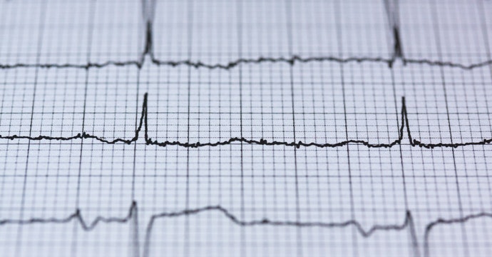 搞懂15個心臟病迷思，防堵心臟病
